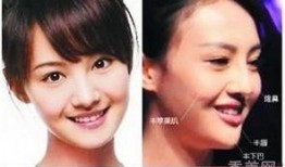 西安整容爆料事件真相视频,真相视频曝光背后的真相